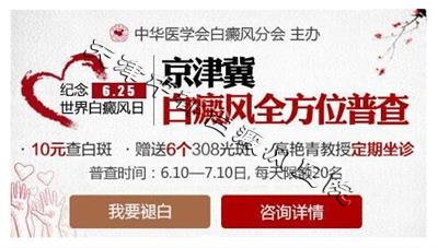 白癜風治療