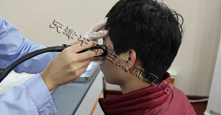 白癜風