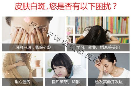 早期白癜風癥狀和圖片