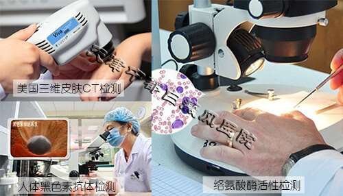 出現白斑該如何做呢？