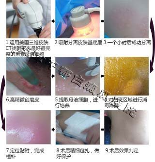 白癜風(fēng)的常見原因有哪些？