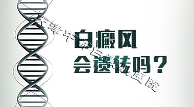 白癜風(fēng)會(huì)不會(huì)遺傳給孩子?