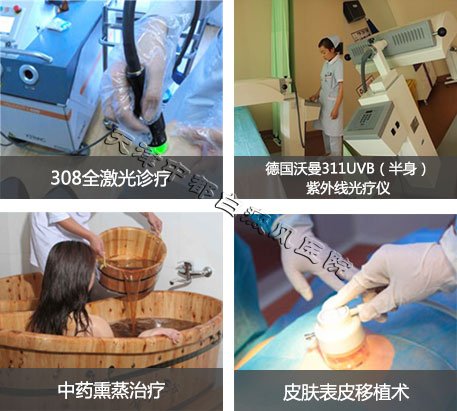女性白癜風怎么治療呢?