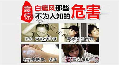 春季萬物復蘇，小心白癜風的復發