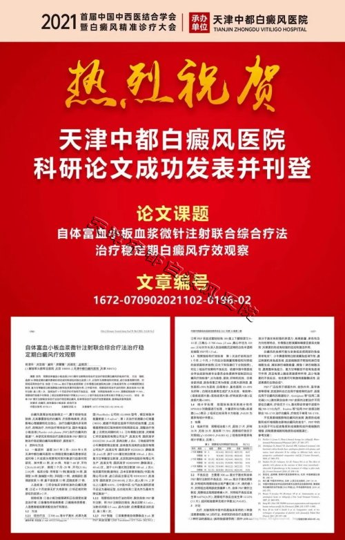 天津白癜風醫院
