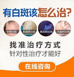 天津白癜風醫院哪家好？