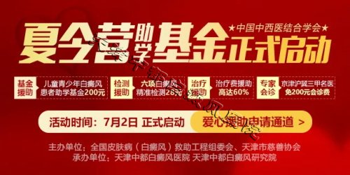天津白癜風醫院