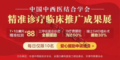 天津中都白癜風(fēng)醫(yī)院
