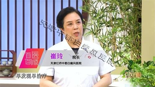 天津白癜風(fēng)醫(yī)院